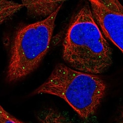 Inorganic Pyrophosphatase/PPA1 Antibody, Novus Biologicals 0.1mL; Unlabeled:Antibodies,